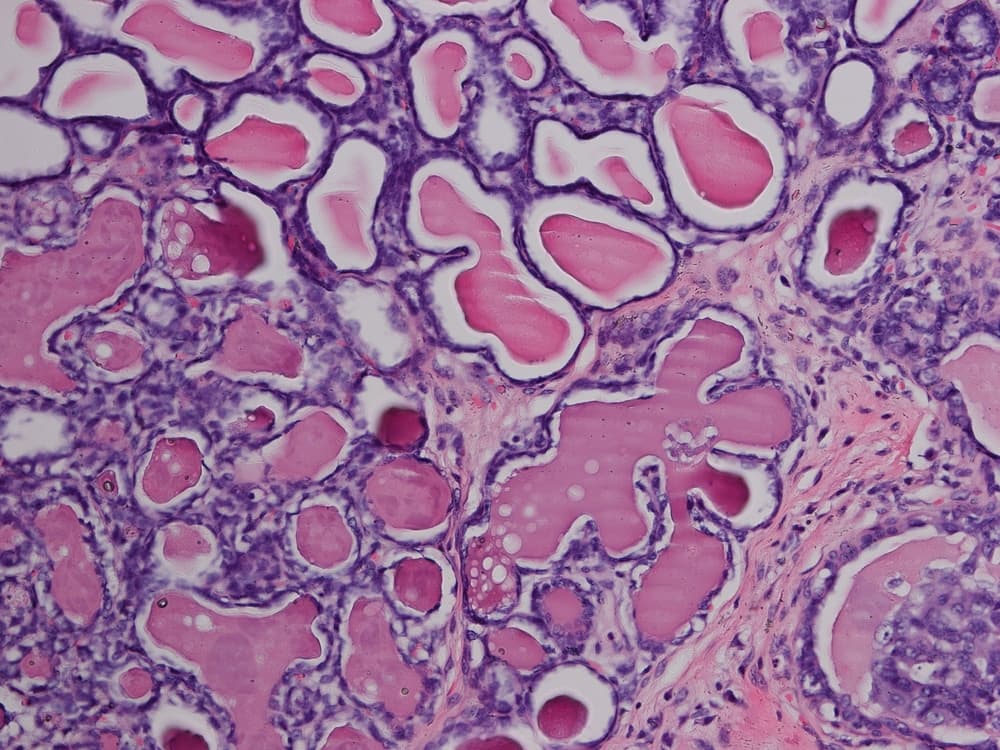 Microscopic image of normal mammary glands in a female dog showing no signs of cancer.